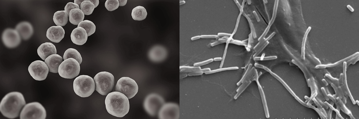他の乳酸菌との決定的な違い